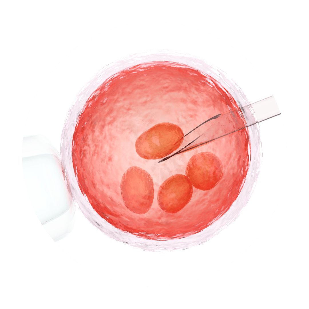 Bild einer künstlichen Befruchtung, Kinderwunsch bei Endometriose